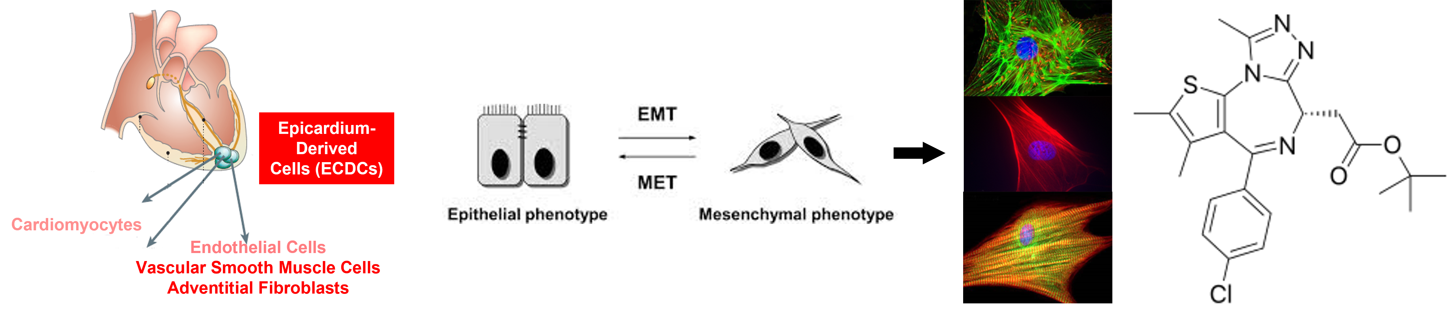 cardiac repair